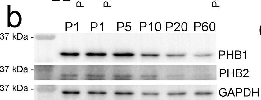 Fig.2.B showing Western Blotting in a Mus musculus (House mouse) sample from the publication: Prohibitin 1 is essential to preserve mitochondria and myelin integrity in Schwann cells.