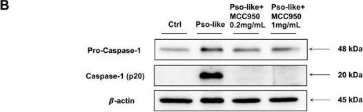 Fig.1.B showing Western Blotting in a Mus musculus (House mouse) sample from the publication: Skin Application of Inflammasome Inhibitor MCC950 Prevents Psoriasis-like Cutaneous Manifestations and Associated Systemic Inflammation.