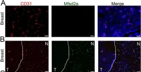 Fig.2.A showing Immunohistochemistry-immunofluorescence from the publication: Metastatic Brain Tumors Disrupt the Blood-Brain Barrier and Alter Lipid Metabolism by Inhibiting Expression of the Endothelial Cell Fatty Acid Transporter Mfsd2a.