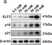 Fig.2.G showing Western Blotting from the publication: ELF3 promotes hyperglycemia-induced corneal epithelial senescence and IL-2 attenuates ELF3-associated signaling.