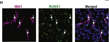 Fig.1.H showing Immunohistochemistry-immunofluorescence in a Homo sapiens (Human) sample from the publication: A systematic characterization of microglia-like cell occurrence during retinal organoid differentiation.