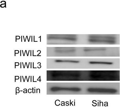 Fig.2.A showing Western Blotting in a Homo sapiens (Human) sample from the publication: piRNA-14633 promotes cervical cancer cell malignancy in a METTL14-dependent m6A RNA methylation manner.