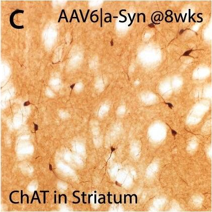 Fig.9.C showing Western Blotting in a Rattus norvegicus (Rat) sample from the publication: Novel AAV-based rat model of forebrain synucleinopathy shows extensive pathologies and progressive loss of cholinergic interneurons.