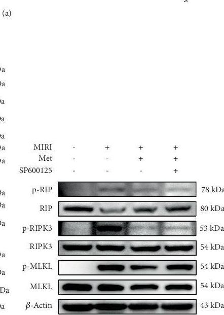 Fig.5.A showing Western Blotting from the publication: Metformin Attenuates Myocardial Ischemia-Reperfusion Injury in Rats by Modulating JNK Pathway and Inhibiting PANoptosis Mechanisms.