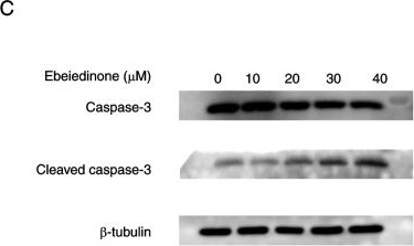 Fig.9.C showing Western Blotting in a Homo sapiens (Human) sample from the publication: Mechanism of action of alkaloids in Fritillaria-induced autophagy and apoptosis in non-small cell lung cancer.