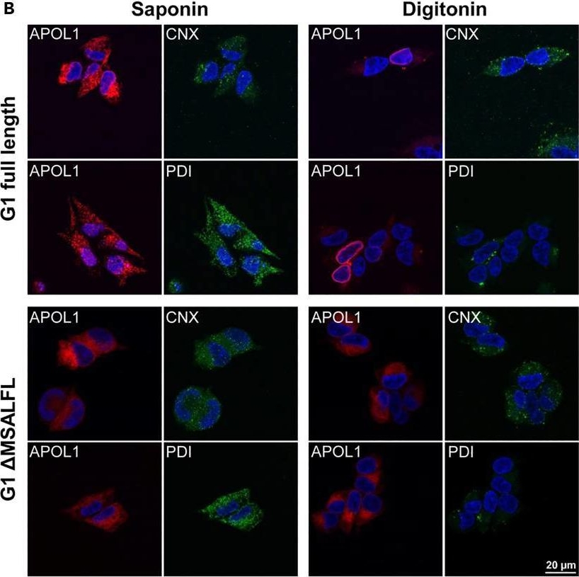 Fig.3.B showing Immunocytochemistry-immunofluorescence in a Homo sapiens (Human) sample from the publication: Endoplasmic reticulum-translocation is essential for APOL1 cellular toxicity.