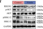 Fig.1.F showing Western Blotting from the publication: Mechanically Active Hydrogel for Healing Intestinal Fistulas through the YAP-Mediated Mechanosensitization of Intestinal Epithelial Cells.