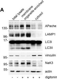 Fig.2.A showing Western Blotting in a Mus musculus (House mouse) sample from the publication: Apache is a neuronal player in autophagy required for retrograde axonal transport of autophagosomes.