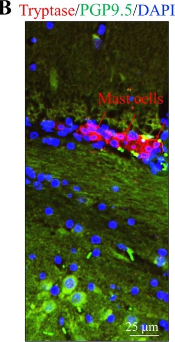 Fig.1.B showing Immunohistochemistry-immunofluorescence from the publication: Amyloid Beta Peptides Lead to Mast Cell Activation in a Novel 3D Hydrogel Model.