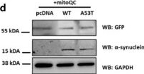 Fig.1.D showing Western Blotting in a Homo sapiens (Human) sample from the publication: Mitophagy Upregulation Occurs Early in the Neurodegenerative Process Mediated by α-Synuclein.