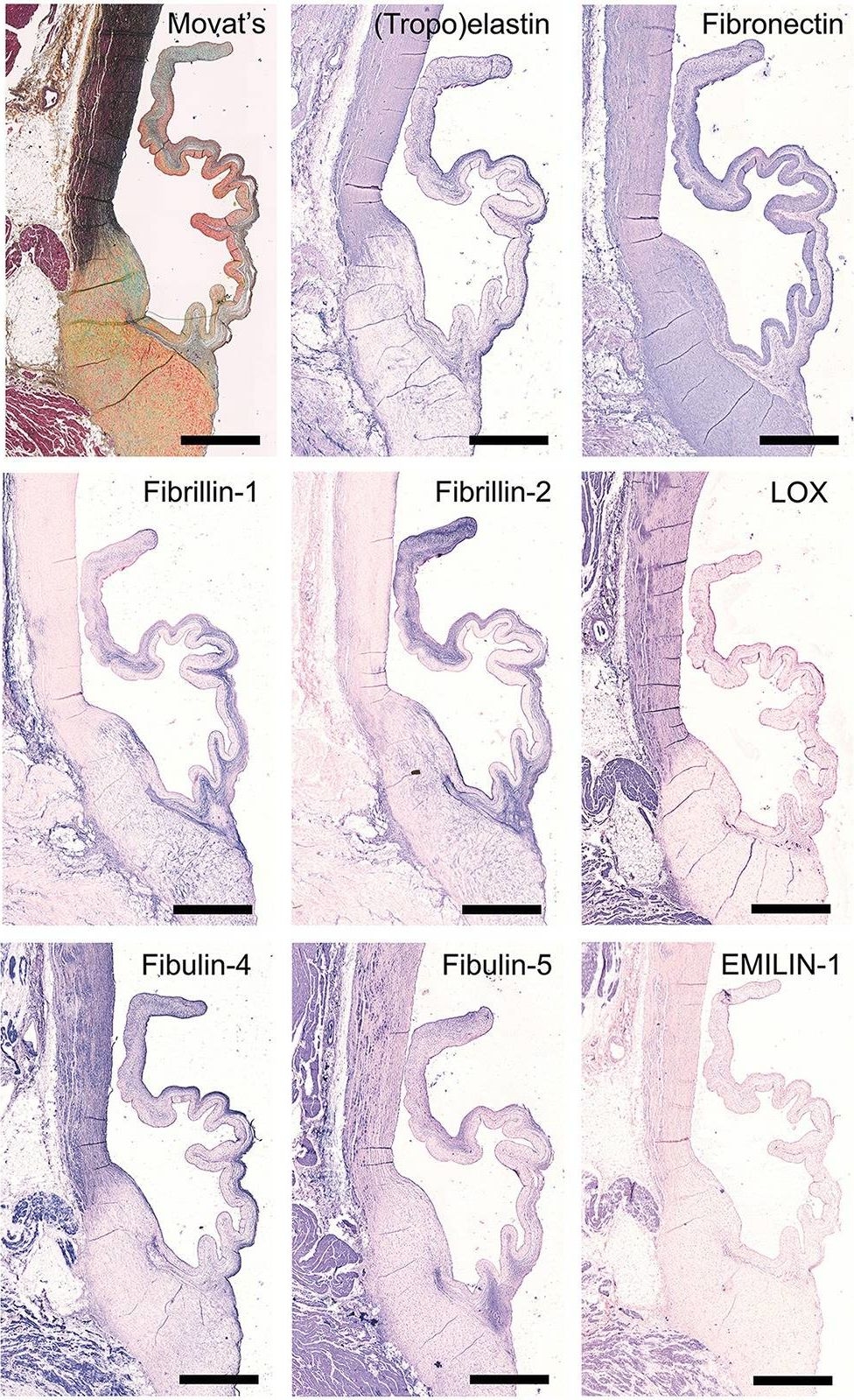 Fig.4.A showing Immunohistochemistry-paraffin in an Ovis aries (Sheep) sample from the publication: Sheep-Specific Immunohistochemical Panel for the Evaluation of Regenerative and Inflammatory Processes in Tissue-Engineered Heart Valves.