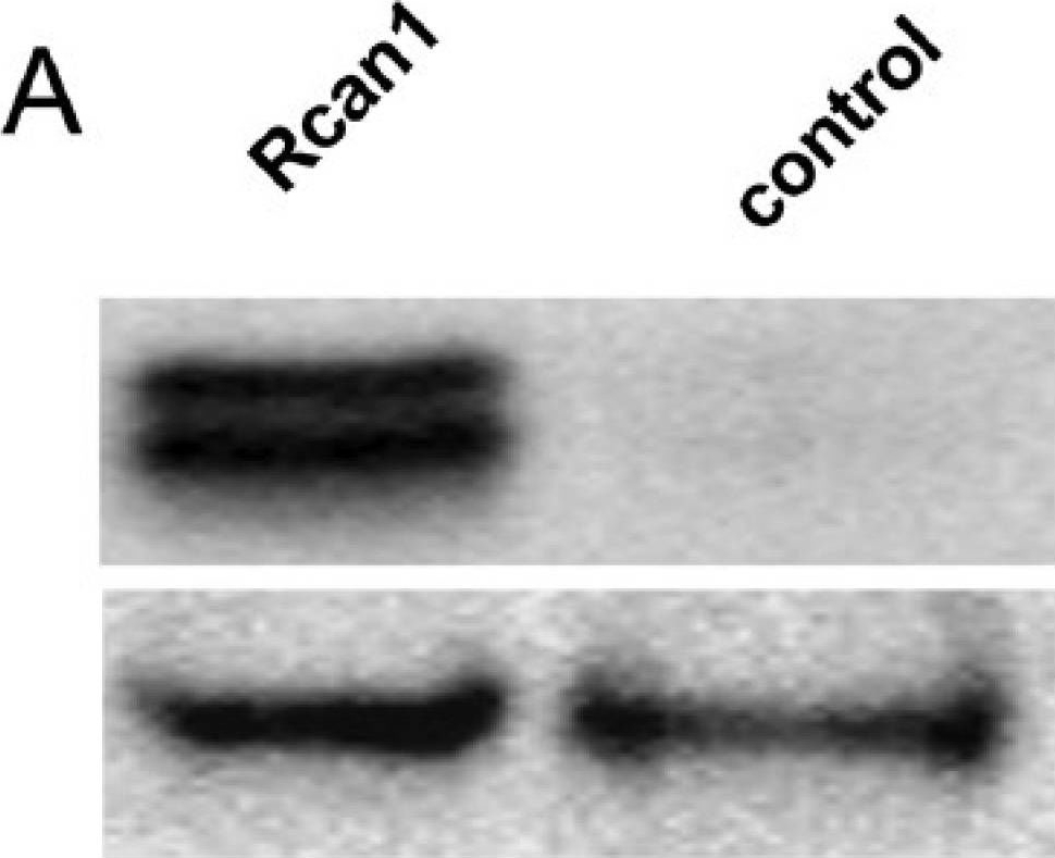 Fig.2.A showing Western Blotting in a Mus musculus (House mouse) sample from the publication: Overexpression of RCAN1, a Gene on Human Chromosome 21, Alters Cell Redox and Mitochondrial Function in Enamel Cells.