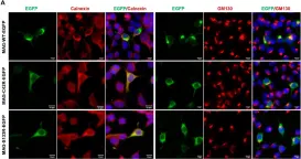 Fig.3.A showing Immunocytochemistry-immunofluorescence in a Homo sapiens (Human) sample from the publication: Novel MAG Variant Causes Cerebellar Ataxia with Oculomotor Apraxia: Molecular Basis and Expanded Clinical Phenotype.