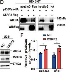 Fig.6.D showing Western Blotting from the publication: CSRP2 promotes the glioblastoma mesenchymal phenotype via p130Cas-mediated NF-κB and MAPK pathways.