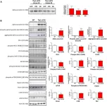 Fig.6.A showing Western Blotting from the publication: Overexpression of Wild-Type Human Alpha-Synuclein Causes Metabolism Abnormalities in Thy1-aSYN Transgenic Mice.