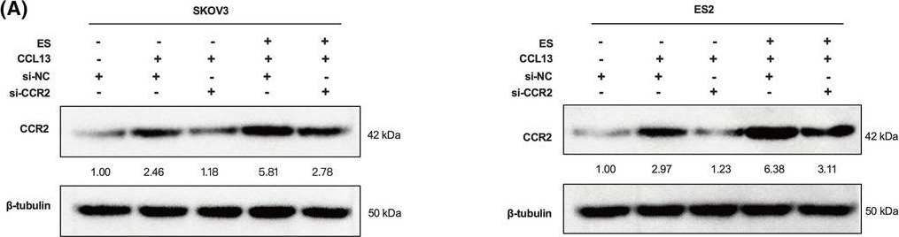 Fig.7.A showing Western Blotting from the publication: Tumour-derived exosome SNHG17 induced by oestrogen contributes to ovarian cancer progression via the CCL13-CCR2-M2 macrophage axis.
