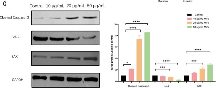 Fig.4.G showing Western Blotting from the publication: Listeria monocytogenes-Derived Membrane Vesicles Suppress Melanoma Growth via Macrophage Activation Involving NF-κB Signaling.