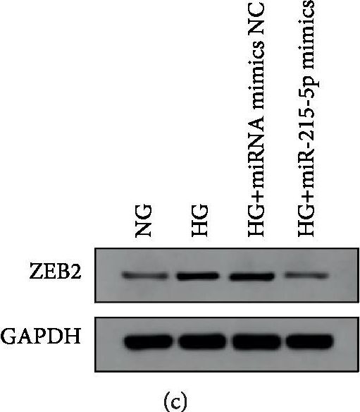 Fig.5.C showing Chromatin immunoprecipitation in a Mus musculus (House mouse) sample from the publication: Exosomal miRNA-215-5p Derived from Adipose-Derived Stem Cells Attenuates Epithelial-Mesenchymal Transition of Podocytes by Inhibiting ZEB2.