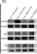 Fig.4.E showing Western Blotting in a Spider sample from the publication: Hyperoside alleviates endometrial stromal cell senescence in unexplained recurrent spontaneous abortion via DHX9-mediated R-loop resolution.
