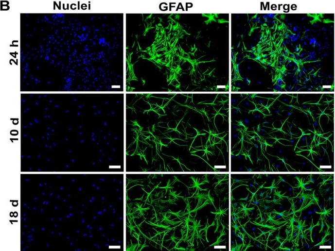 Fig.5.B showing Immunocytochemistry-immunofluorescence from the publication: In vivo and in vitro susceptibility and inflammatory response of postnatal mouse cortical neurons and glial cells to zika virus infection.
