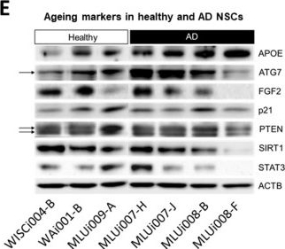 Fig.3.E showing Western Blotting from the publication: Neuronal Stem Cells from Late-Onset Alzheimer Patients Show Altered Regulation of Sirtuin 1 Depending on Apolipoprotein E Indicating Disturbed Stem Cell Plasticity.