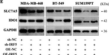 Fig.4.E showing Western Blotting from the publication: Isoliquiritigenin Inhibits Triple-Negative Breast Cancer Progression via Targeting the IRF5/SLC7A5/IDO1-Mediated Tryptophan Metabolism Pathway.