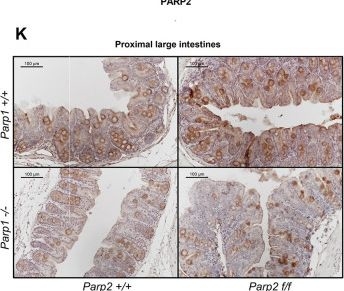 Fig.5.K showing Immunohistochemistry from the publication: Knockout of PARP2 in T cells leads to spontaneous colitis with distinct segmental characteristics in PARP1-deficient mice.