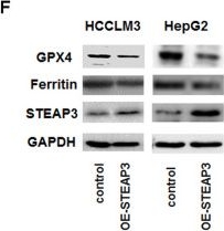 Fig.6.F showing Western Blotting in a Homo sapiens (Human) sample from the publication: Matrix stiffness-dependent STEAP3 coordinated with PD-L2 identify tumor responding to sorafenib treatment in hepatocellular carcinoma.