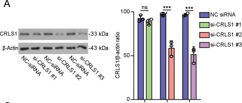 Fig.3.A showing Western Blotting in a Mus musculus (House mouse) sample from the publication: Anti-alcoholism drug disulfiram inhibits PANoptosis by blocking mitochondrial permeabilization in macrophages.