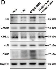 Fig.4.D showing Western Blotting from the publication: Conductive Hydrogel Inspires Neutrophil Extracellular Traps to Combat Bacterial Infections in Wounds.