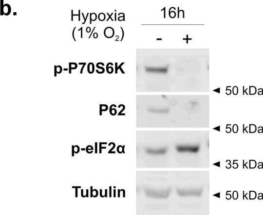 Hypoxia-induced HIF1α activation regulates small extracellular vesicle release in human embryonic kidney cells.
