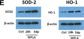 Fig.4.E showing Western Blotting from the publication: Monophosphoryl lipid A boosts macrophage antimicrobial immunity by metabolically regulating source-specific ROS generation.
