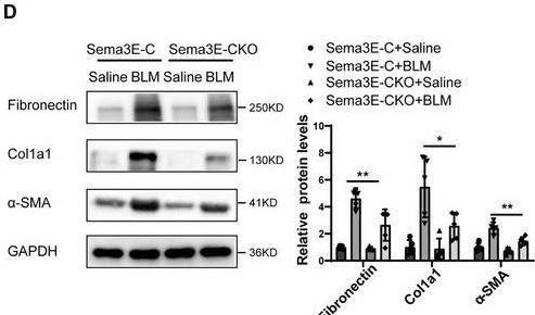 Fig.7.D showing Western Blotting in a Mus musculus (House mouse) sample from the publication: Semaphorin 3E-Plexin D1 Axis Drives Lung Fibrosis through ErbB2-Mediated Fibroblast Activation.