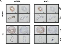 Fig.6.A showing Immunohistochemistry in a Mus musculus (House mouse) sample from the publication: Developing a Reliable Mouse Model for Cancer Therapy-Induced Cardiovascular Toxicity in Cancer Patients and Survivors.