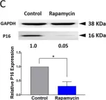 Fig.5.C showing Western Blotting from the publication: Rapamycin Prolongs the Survival of Corneal Epithelial Cells in Culture.