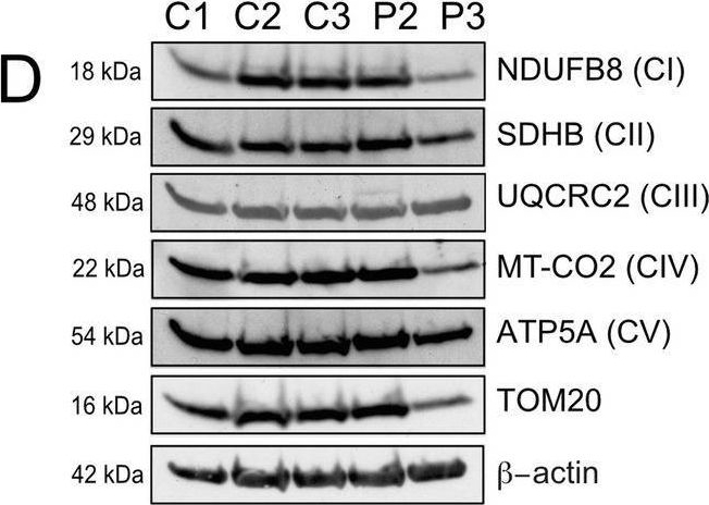 Fig.6.D showing Western Blotting in a Homo sapiens (Human) sample from the publication: Pathogenic PDE12 variants impair mitochondrial RNA processing causing neonatal mitochondrial disease.