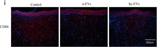 Fig.7.I showing Immunohistochemistry-immunofluorescence in a Homo sapiens (Human) sample from the publication: Hypoxia-Induced Extracellular Vesicles Derived from Human Umbilical Cord Mesenchymal Stem Cells Regulate Macrophage Polarization and Enhance Angiogenesis to Promote Diabetic Wound Healing.