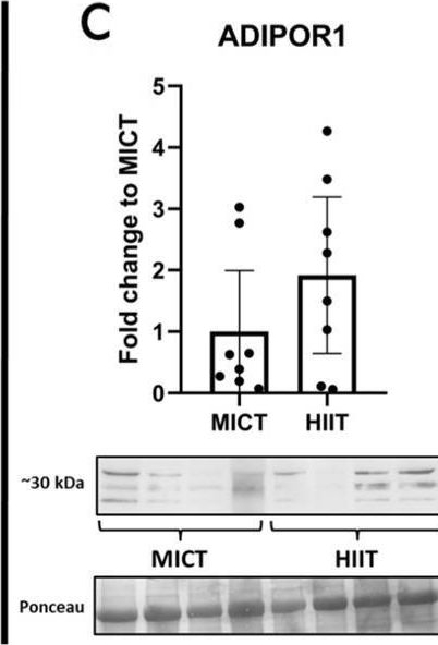 Fig.5.C showing Western Blotting in a Homo sapiens (Human) sample from the publication: Moderate-Intensity Constant and High-Intensity Interval Training Confer Differential Metabolic Benefits in Skeletal Muscle, White Adipose Tissue, and Liver of Candidates to Undergo Bariatric Surgery.