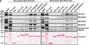 Fig.7.A showing Western Blotting in a Homo sapiens (Human) sample from the publication: Members of the autophagy class III phosphatidylinositol 3-kinase complex I interact with GABARAP and GABARAPL1 via LIR motifs.