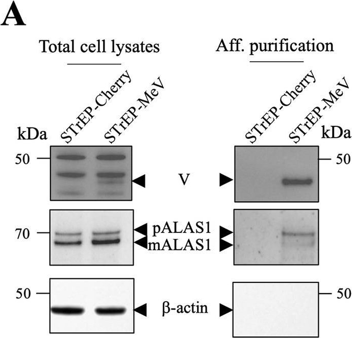 Fig.4.A showing Western Blotting in a Homo sapiens (Human) sample from the publication: Antagonism of ALAS1 by the Measles Virus V protein contributes to degradation of the mitochondrial network and promotes interferon response.