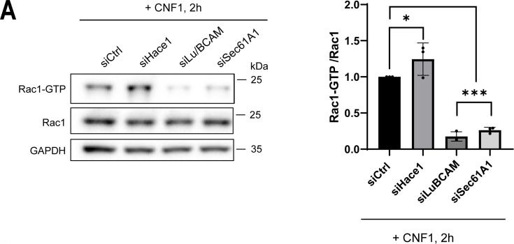 Fig.4.A showing Western Blotting from the publication: Screening of gene function in cell intoxication by CNF1 links Sec61 translocon to Rac1 GTPase activity.