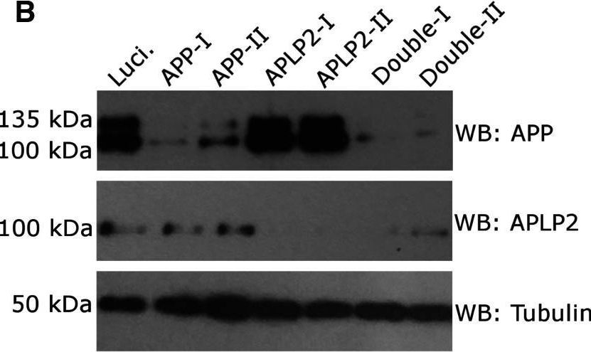 Fig.3.B showing Western Blotting in a Homo sapiens (Human) sample from the publication: APP controls the formation of PI(3,5)P(2) vesicles through its binding of the PIKfyve complex.