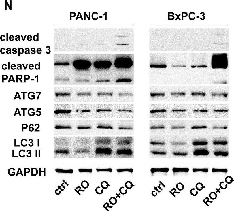 Fig.5.N showing Western Blotting in a Homo sapiens (Human) sample from the publication: Autophagic Schwann cells promote perineural invasion mediated by the NGF/ATG7 paracrine pathway in pancreatic cancer.