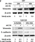 Fig.2.F showing Western Blotting from the publication: C3G downregulation induces the acquisition of a mesenchymal phenotype that enhances aggressiveness of glioblastoma cells.