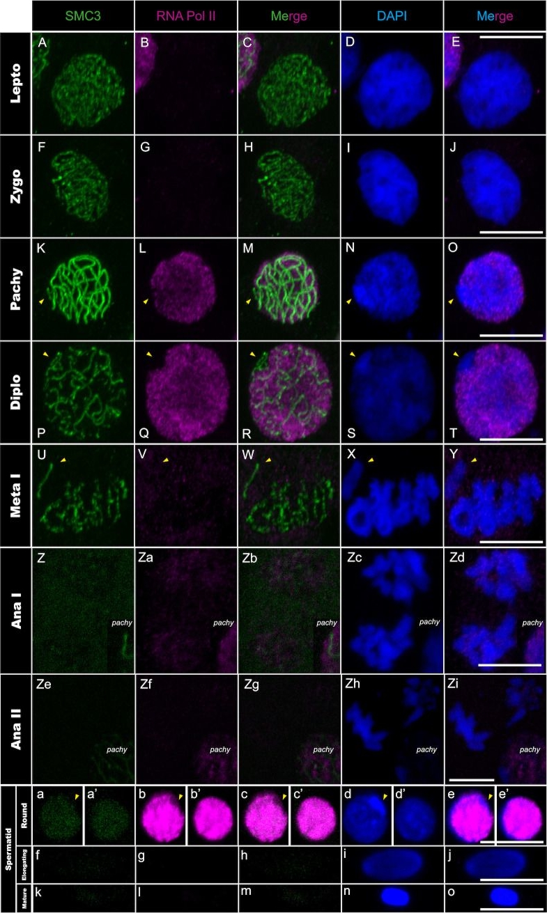 Fig.3.A showing Immunocytochemistry-immunofluorescence from the publication: Dynamics of recombination, X inactivation and centromere proteins during stick insect spermatogenesis.