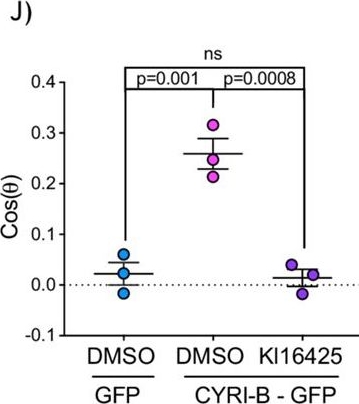 Fig.4.J from the publication: CYRI-B-mediated macropinocytosis drives metastasis via lysophosphatidic acid receptor uptake.