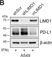 Fig.1.B showing Western Blotting from the publication: Clonal LIMD1 loss drives PD-L1 immune evasion via ARIH1-dependent ubiquitination in lung cancer.