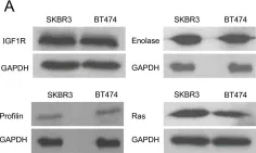 Fig.6.A showing Western Blotting in a Homo sapiens (Human) sample from the publication: Inferring predominant pathways in cellular models of breast cancer using limited sample proteomic profiling.