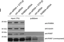 Fig.5.I showing Western Blotting in a Homo sapiens (Human) sample from the publication: The G2019S variant of leucine-rich repeat kinase 2 (LRRK2) alters endolysosomal trafficking by impairing the function of the GTPase RAB8A.