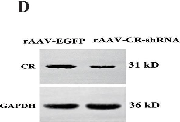 Fig.2.D showing Western Blotting in a Mus musculus (House mouse) sample from the publication: Deficiency of calretinin in prefrontal cortex causes behavioral deficits relevant to autism spectrum disorder in mice.